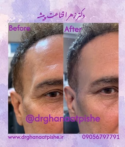 نمونهکار دکتر زهرا قناعت پیشه