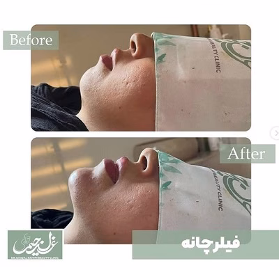نمونهکار دکتر غزل رحیمی