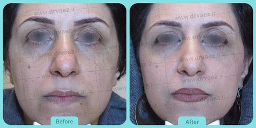 نمونهکار دکتر علیرضا واعظ شوشتری