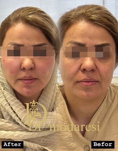 نمونهکار دکتر رامین مدرسی