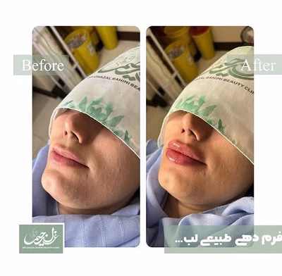 نمونهکار دکتر غزل رحیمی