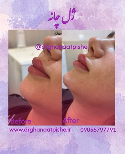 نمونهکار دکتر زهرا قناعت پیشه