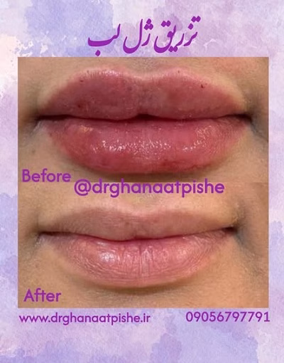 نمونهکار دکتر زهرا قناعت پیشه