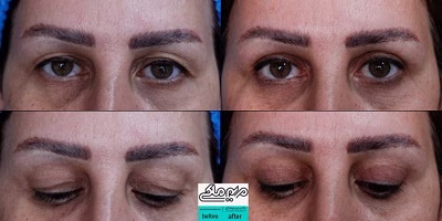 نمونهکار دکتر مریم ملکی