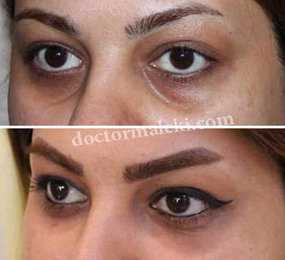 نمونهکار دکتر مریم ملکی