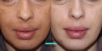نمونهکار دکتر مریم ملکی