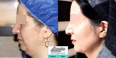 نمونهکار دکتر مریم ملکی