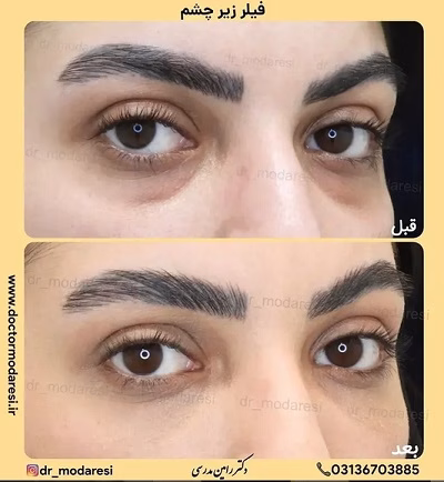 نمونهکار دکتر رامین مدرسی