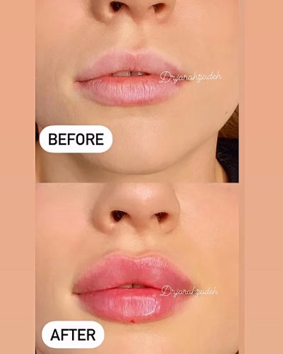 نمونهکار دکتر لیلا جراح زاده