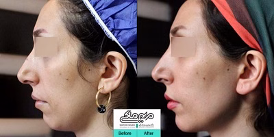 نمونهکار دکتر مریم ملکی