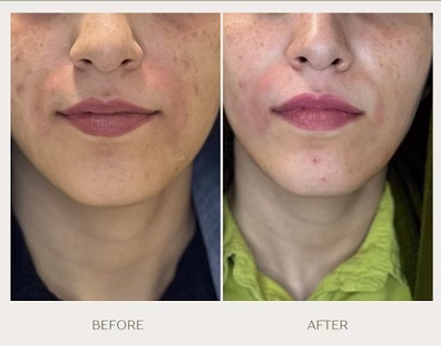 نمونهکار دکتر غزل رحیمی