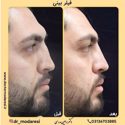 نمونهکار دکتر رامین مدرسی