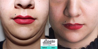 نمونهکار دکتر مریم ملکی