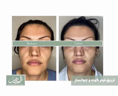 نمونهکار دکتر غزل رحیمی