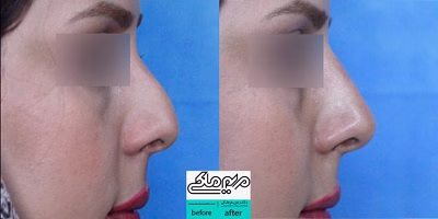 نمونهکار دکتر مریم ملکی