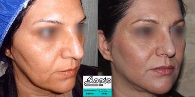نمونهکار دکتر مریم ملکی