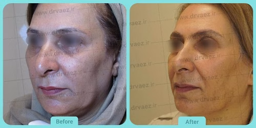 نمونهکار دکتر علیرضا واعظ شوشتری