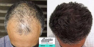 نمونهکار دکتر مریم ملکی
