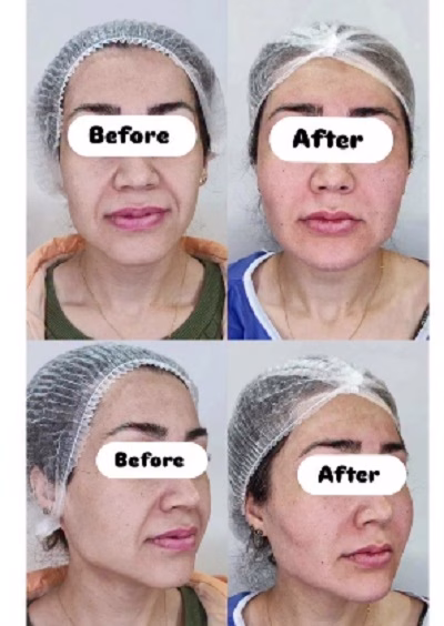 نمونهکار دکتر سپیده سعادتی