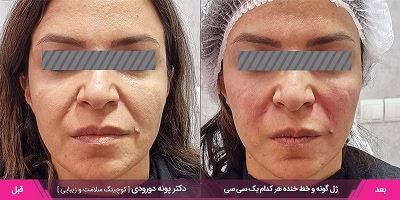 نمونهکار دکتر پونه دورودی