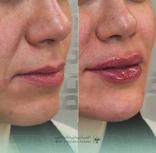 نمونهکار دکتر مجتبی فدایی