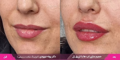 نمونهکار دکتر پونه دورودی
