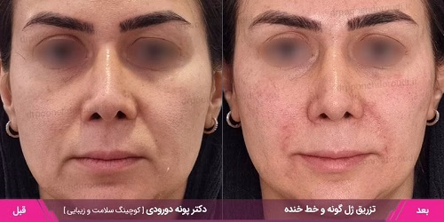 نمونهکار دکتر پونه دورودی