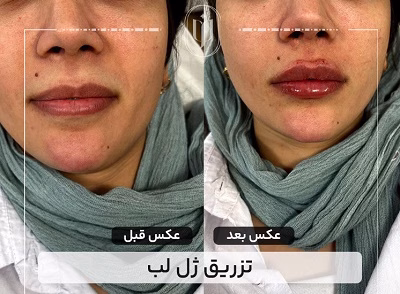 نمونهکار دکتر مریم فروغی