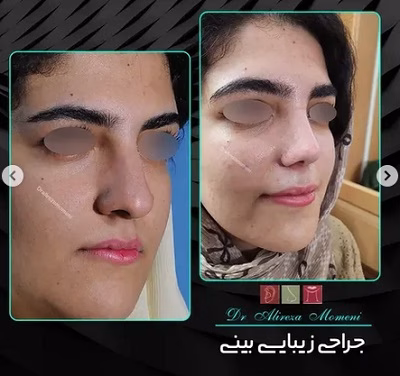 نمونهکار دکتر علیرضا مومنی