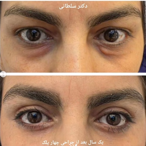 نمونهکار دکتر محمد سلطانی