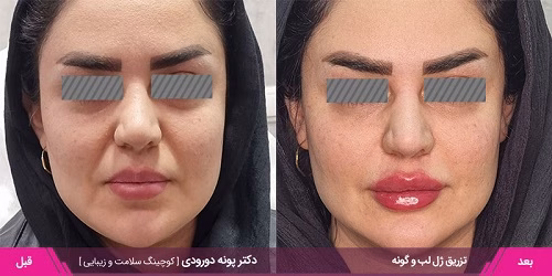 نمونهکار دکتر پونه دورودی