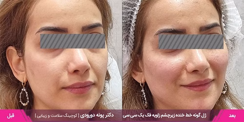 نمونهکار دکتر پونه دورودی
