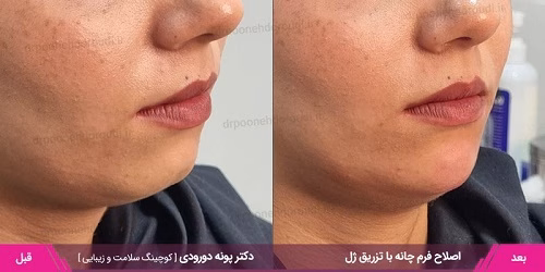 نمونهکار دکتر پونه دورودی