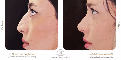 نمونهکار دکتر شهریار لقمانی