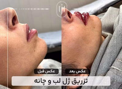 نمونهکار دکتر مریم فروغی