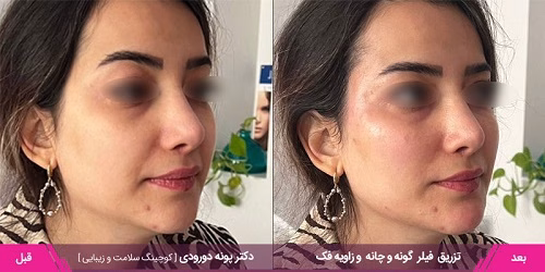 نمونهکار دکتر پونه دورودی
