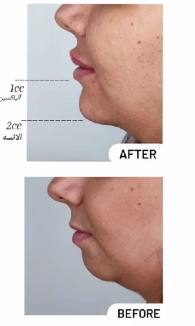 نمونهکار دکتر سپیده سعادتی