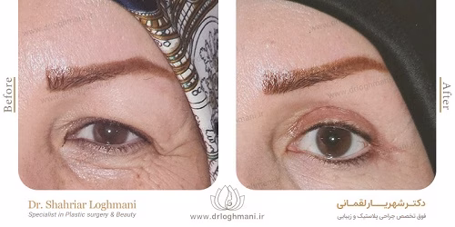 نمونهکار دکتر شهریار لقمانی