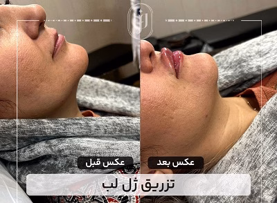 نمونهکار دکتر مریم فروغی