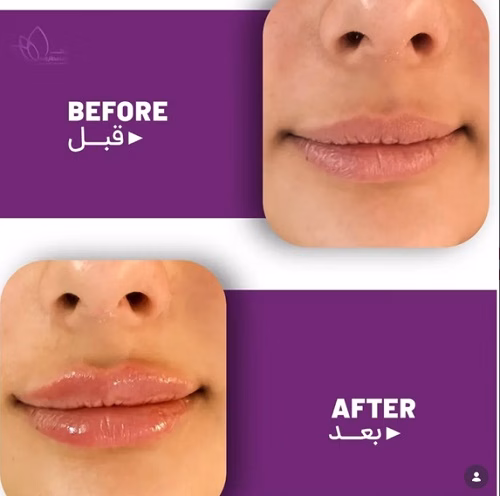 نمونهکار دکتر یلدا عطارزاده