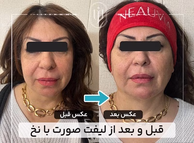 نمونهکار دکتر مریم فروغی