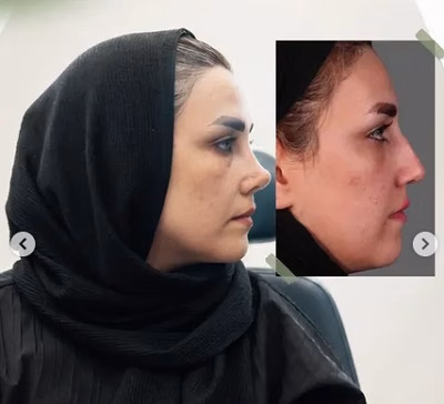 نمونهکار دکتر مهشید خورده چی