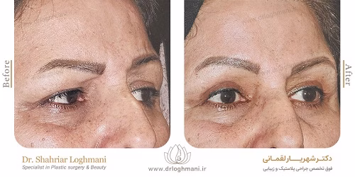 نمونهکار دکتر شهریار لقمانی