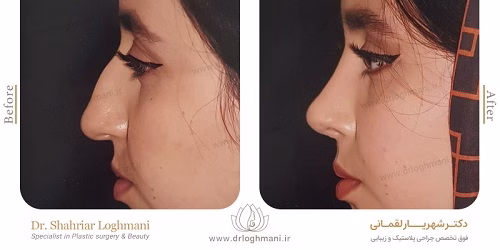 نمونهکار دکتر شهریار لقمانی