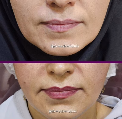 نمونهکار دکتر مینا مسلمی