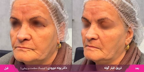 نمونهکار دکتر پونه دورودی