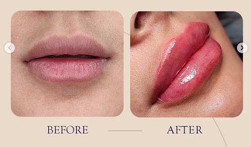 نمونهکار دکتر سپیده سعادتی
