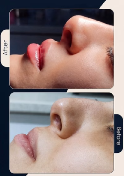 نمونهکار دکتر سپیده سعادتی