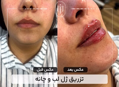 نمونهکار دکتر مریم فروغی