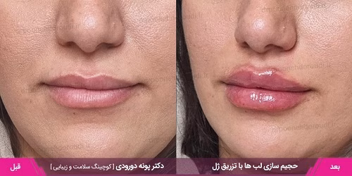 نمونهکار دکتر پونه دورودی